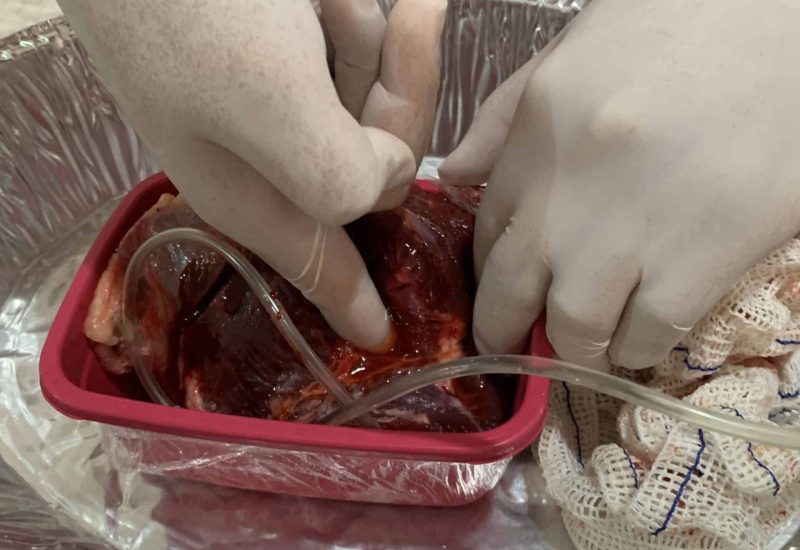 Stop the bleed
